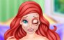 Ariel Göz Kapağı Kozmetik Cerrahi