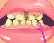 Wybielanie zębów sesji