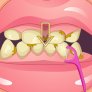 Wybielanie zębów sesji