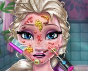 Elsa en el médico: alergia en la cara