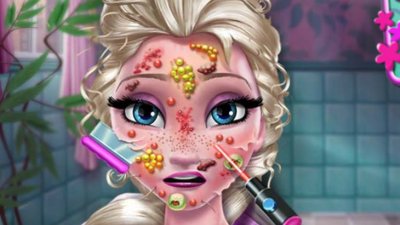 Elsa beim Arzt: Allergie im Gesicht