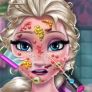 Elsa no médico: alergia no rosto