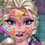 Elsa u lekarza: alergia na twarzy